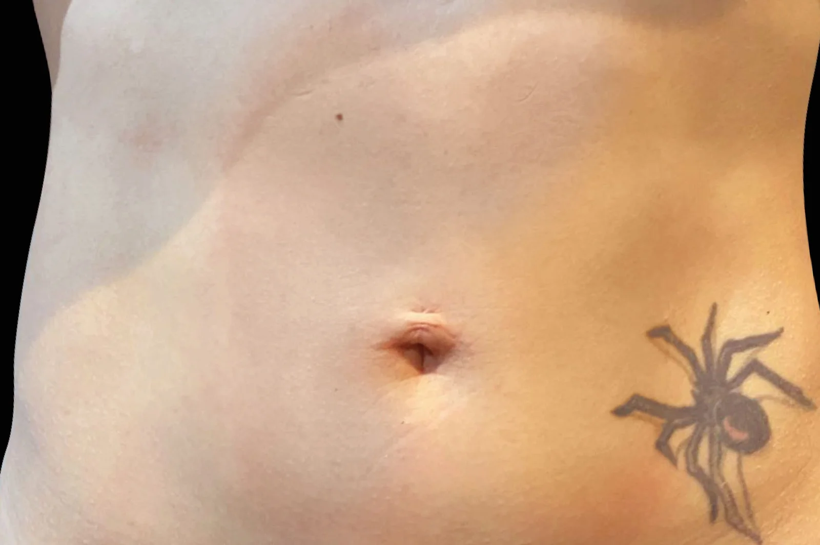 emsculpt-neo-before-after-1-scaled