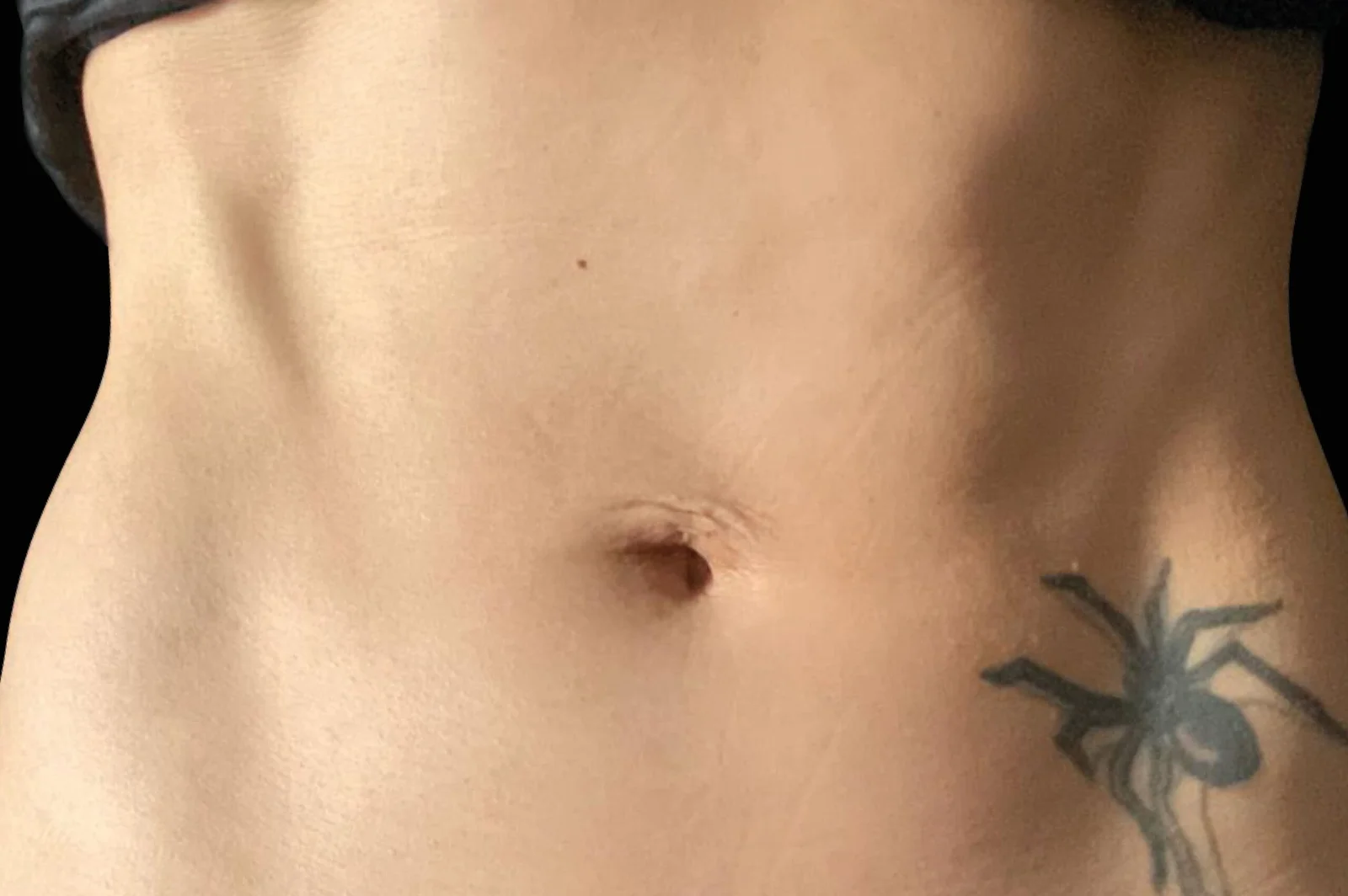 emsculpt-neo-before-after-6-scaled